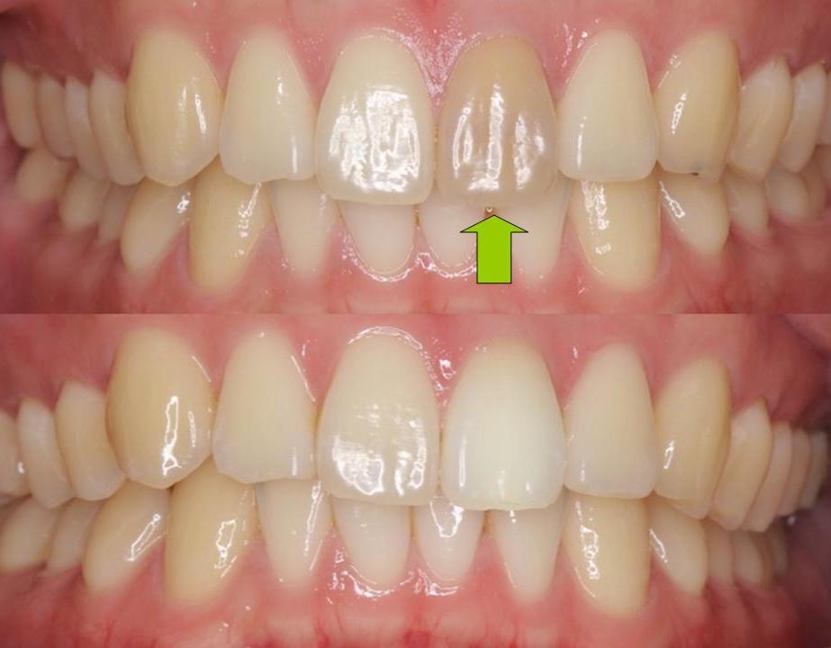 プレゼンテーション1