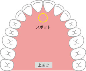 477D112F-4109-440A-ADED-AB7742A38B10-300x248