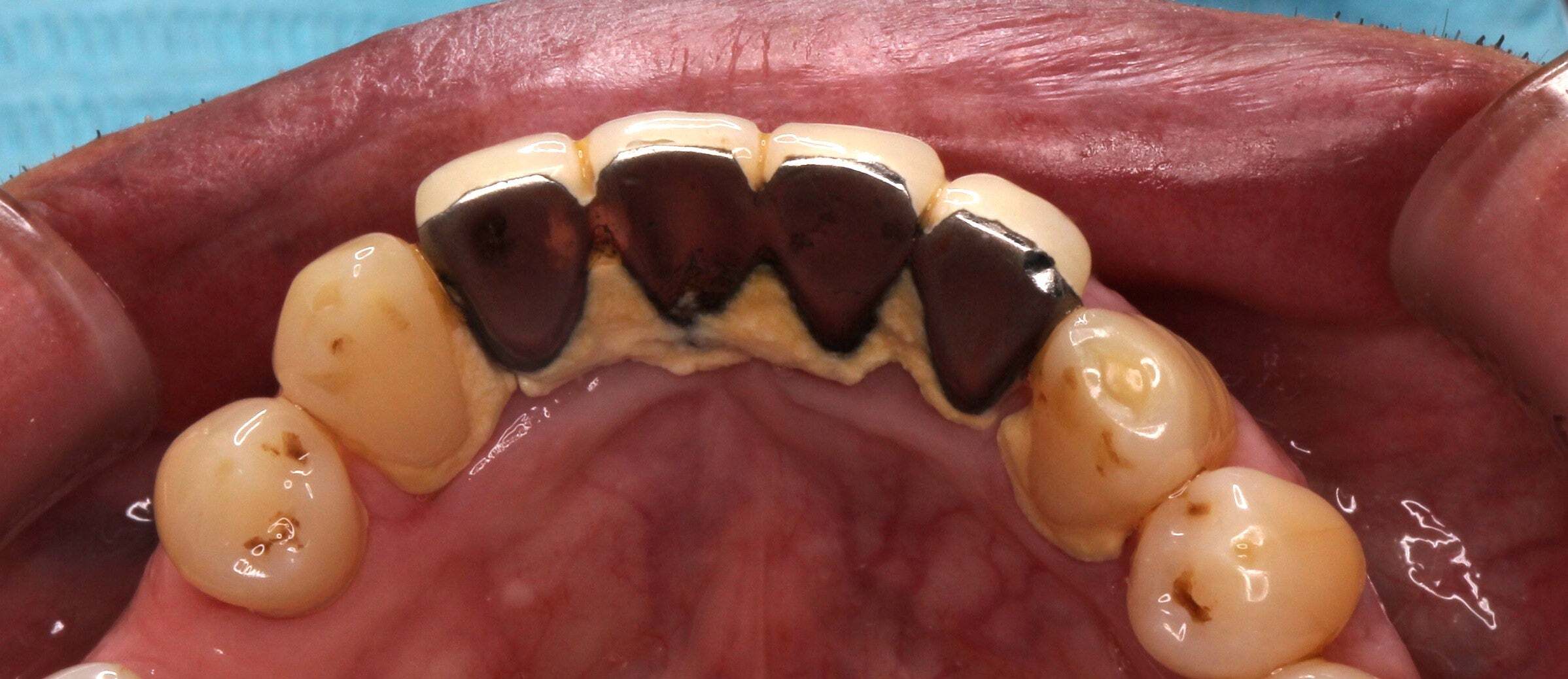 o2397103813964796320