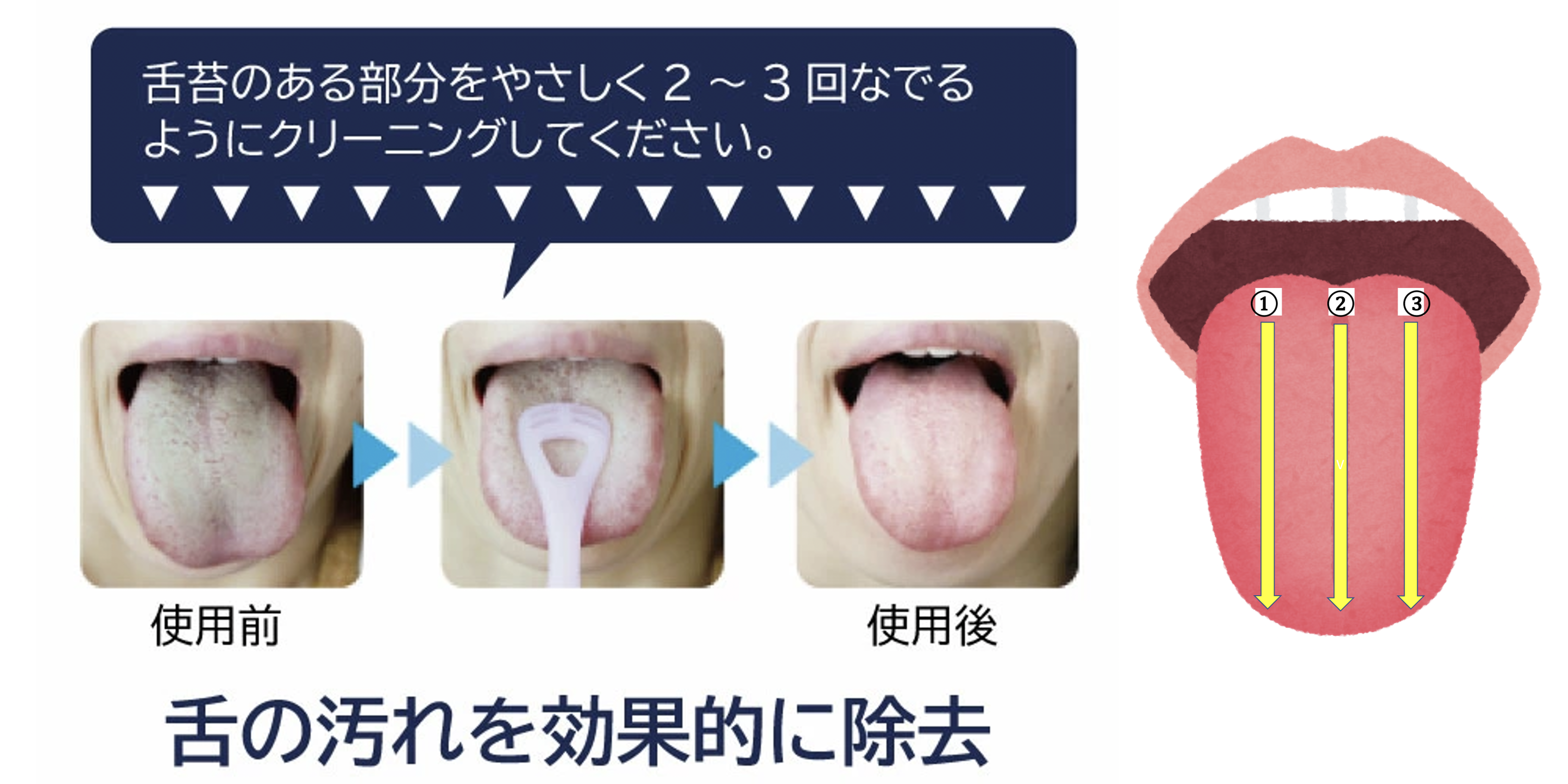 舌磨き